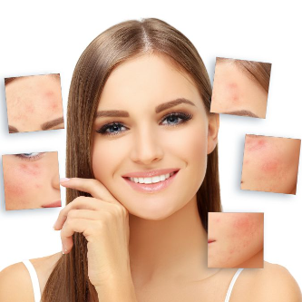 Scar Removal